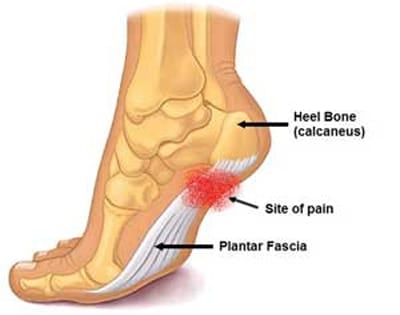 Castro day to day with right foot contusion