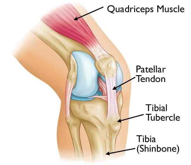 osgood-schlatter